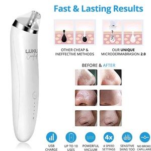 Luxury Confidence- blackhead remover